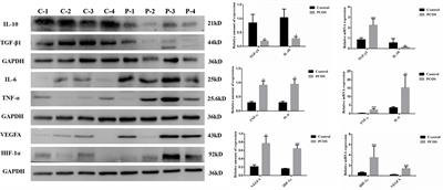 Chitosan oligosaccharide improves ovarian granulosa cells inflammation and oxidative stress in patients with polycystic ovary syndrome